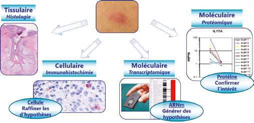 Méthodes utilisées pour la caractérisation des types de rosacée et l’identification de cibles thérapeutiques.